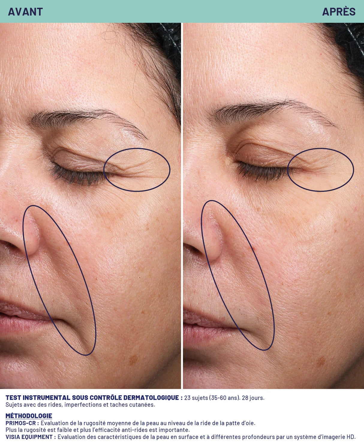 Masque lissant double action